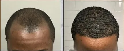 Before and after, example 1