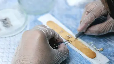 A hair transplant doctor preparing